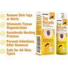 Bee Venom Wart Remover Spray- (Pack of 1)